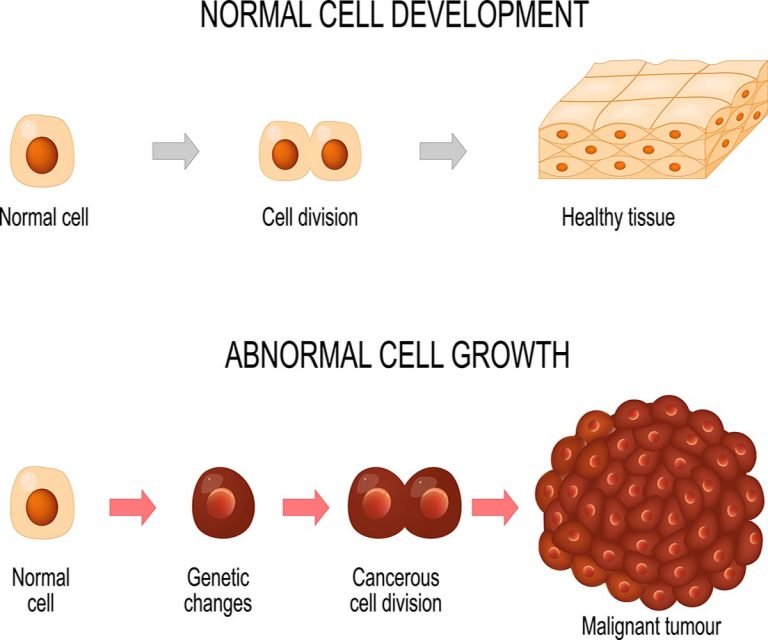 Infrared Sauna Effect on Cancer Cells