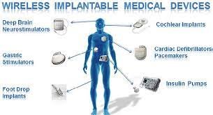 The Future of Health Monitoring Implants