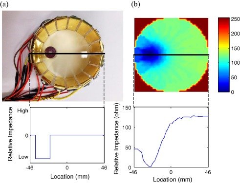 Electrical Impedance Tomography