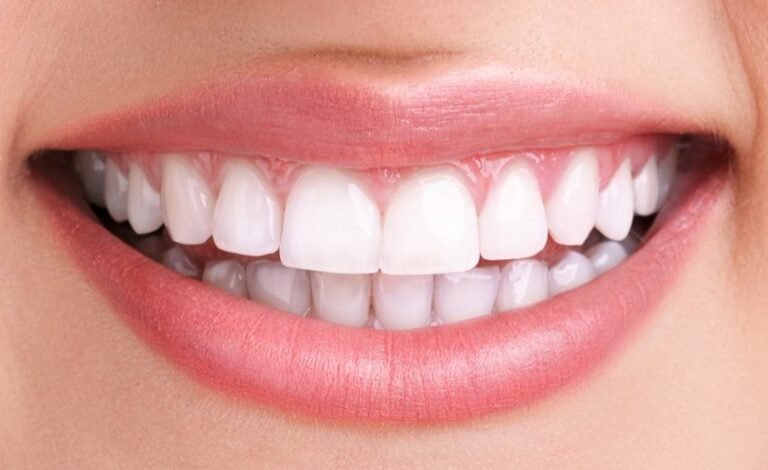 whitening teeth Singapore